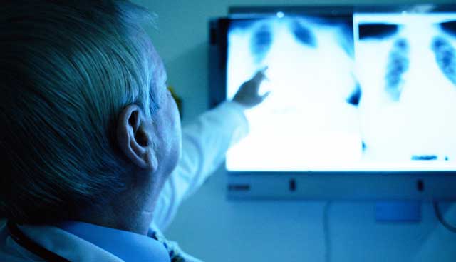 Radiologist reviewing a Mesothelioma Diagnosis in St Petersburg FL