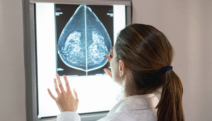 a doctor looks at a diagnostic mammogram scan