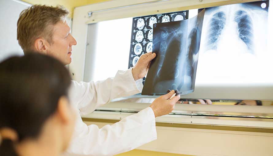 Radiologists looking a lung scans
