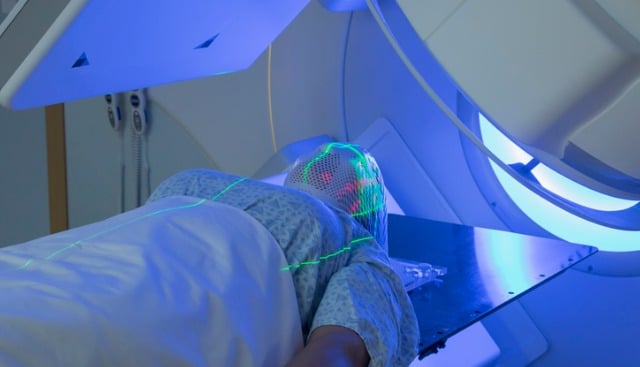 Woman undergoing radiation therapy for meningioma
