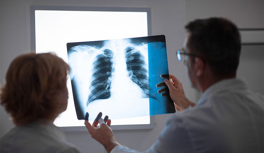 Doctors looking at lung scan