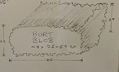 Hoffman drew this picture of his tumor after a scan and named it "Burt."