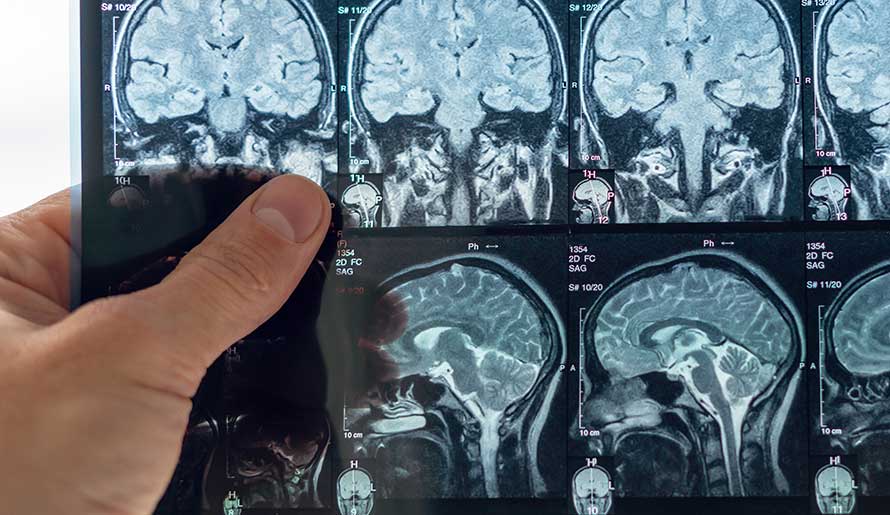 Doctor analyzes an MRI image of the brain.