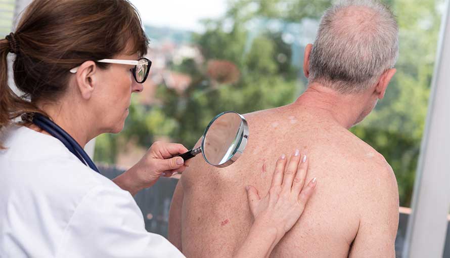 Doctor checking patient's back for squamous cell carcinoma
