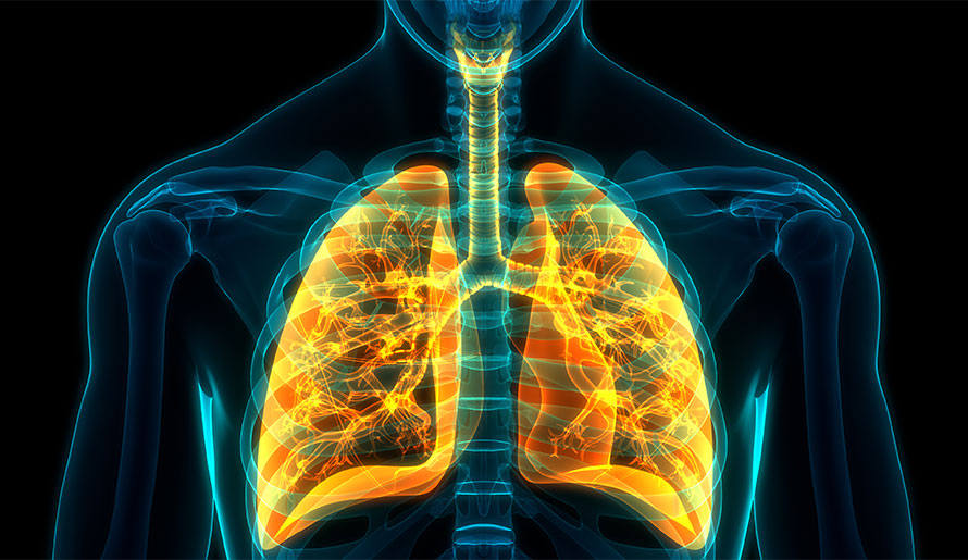 3-D image of lung