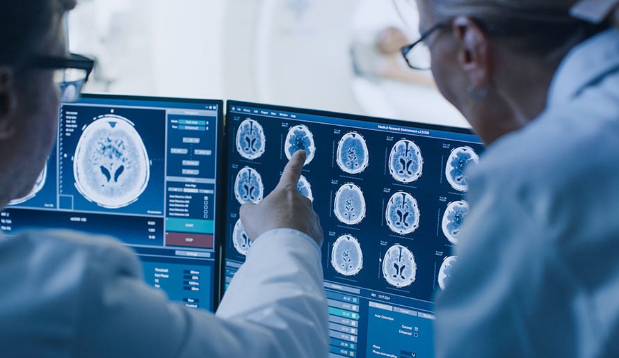 doctors review scans for neurofibromatosis causes