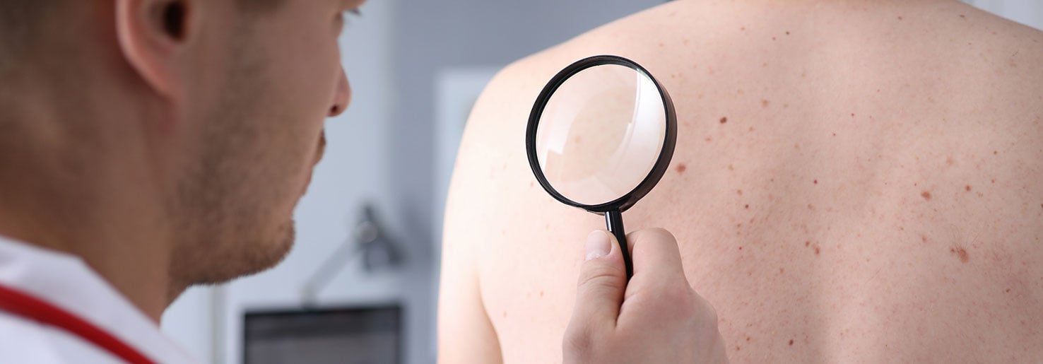 doctor checking moles on man's back